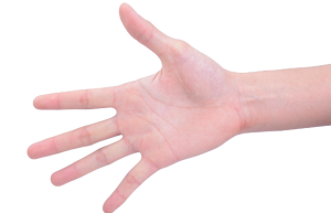 小拇指长痣代表什么意思 小拇指长痣的位置和命运