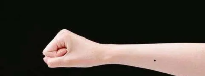 女人右手腕上有痣代表什么预兆 女人右手腕上有痣图解